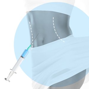 Intradermoterapia (Mesoterapia)